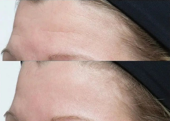 Neuropeptide Facial Cream