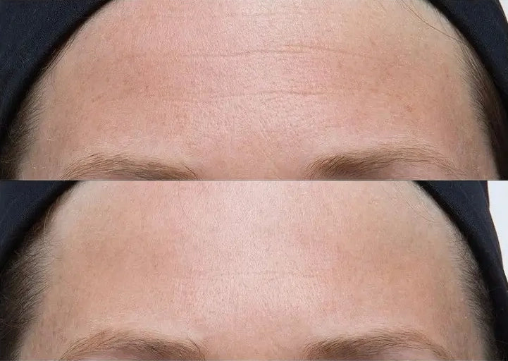 Neuropeptide Facial Cream