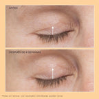 Neuropeptide Eyelid Lift Serum