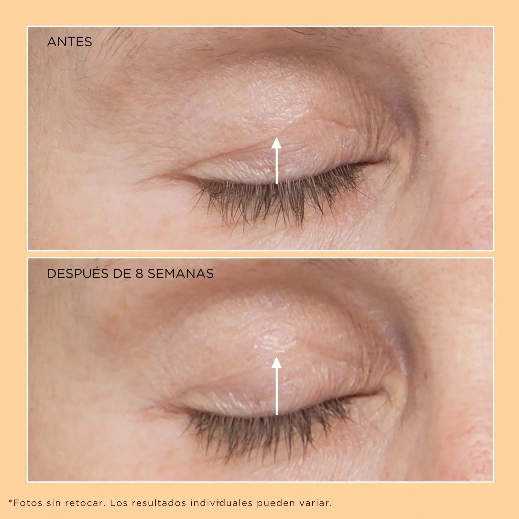 Neuropeptide Eyelid Lift Serum