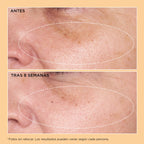 Neuropeptide Rejuvenating Moisturizer SPF 25