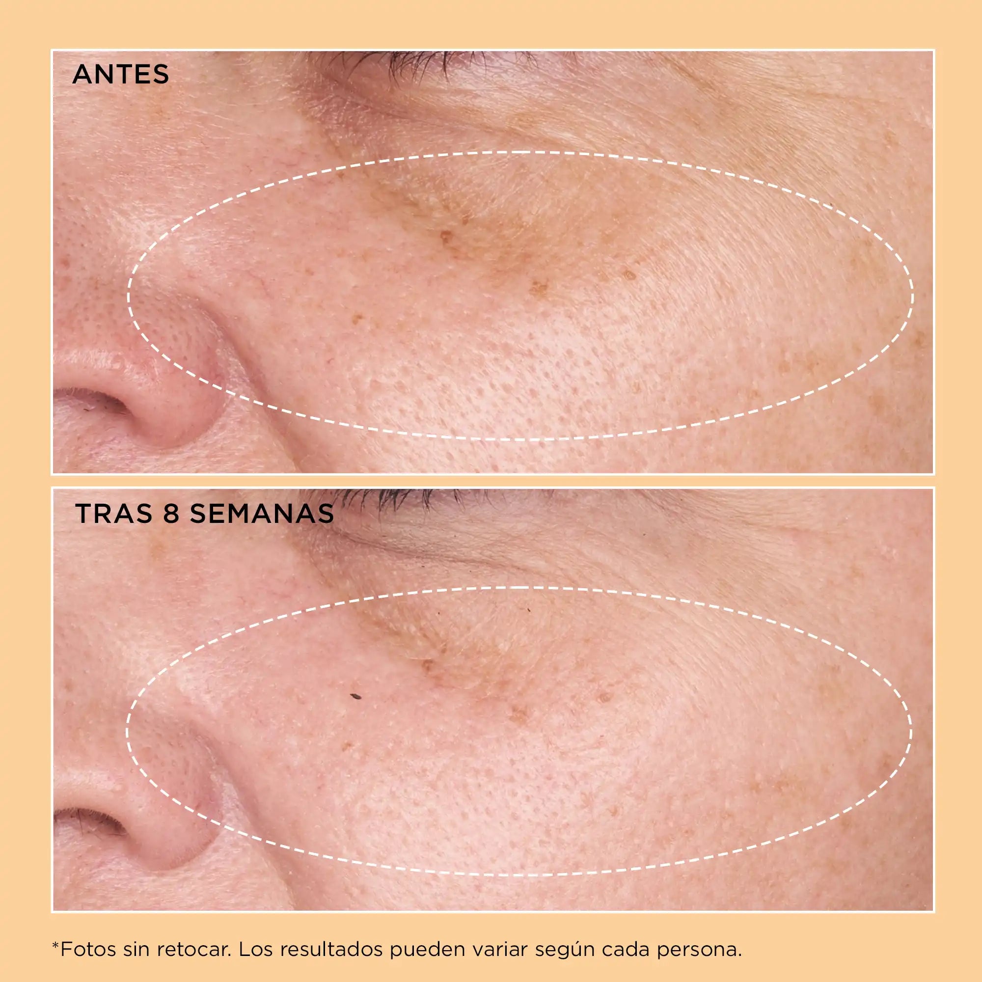 Neuropeptide Rejuvenating Moisturizer SPF 25